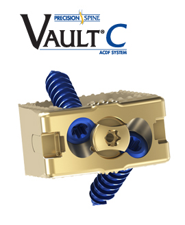The Vault C Anterior Cervical Discectomy and Fusion System (ACDF)